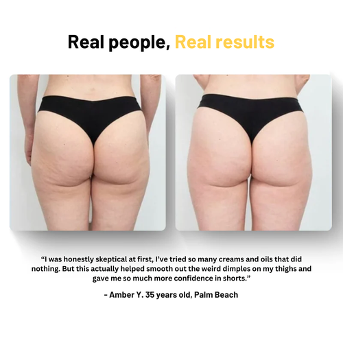 Seloria Anti-Cellulite Massage Oil